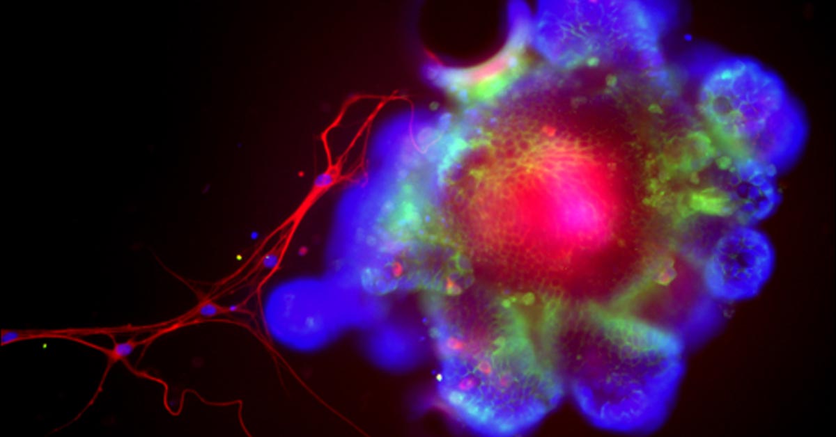 Вчені знайшли білок, що захищає печінку від шкоди алкоголю
