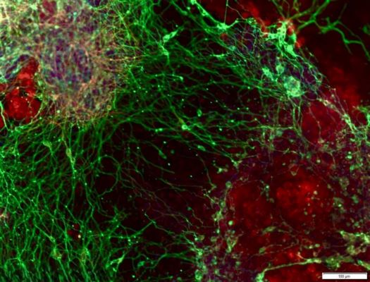 Вчені щойно виявили, як мозок будує себе