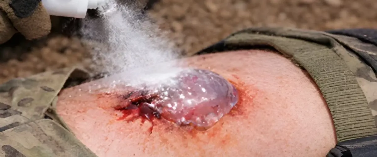 Корейські вчені розробили гель-спрей для екстреної зупинки крові