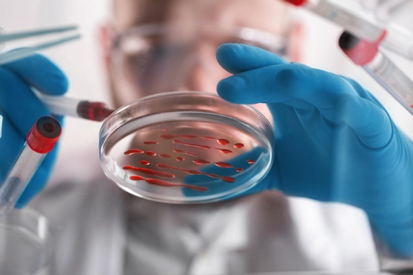 Відкрито групу крові, яка є лише у 3 людей у світі — B(A)